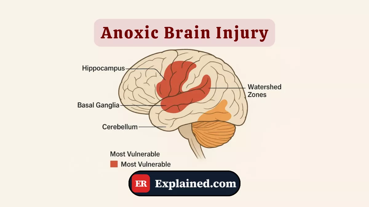 Anoxic Brain Injury: When the Brain Runs Out of Oxygen
