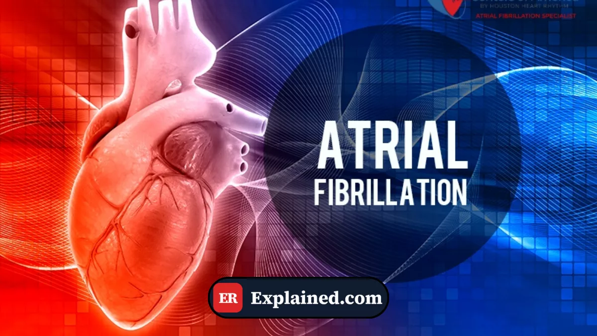 Atrial Fibrillation: When the Heart Loses Its Rhythm