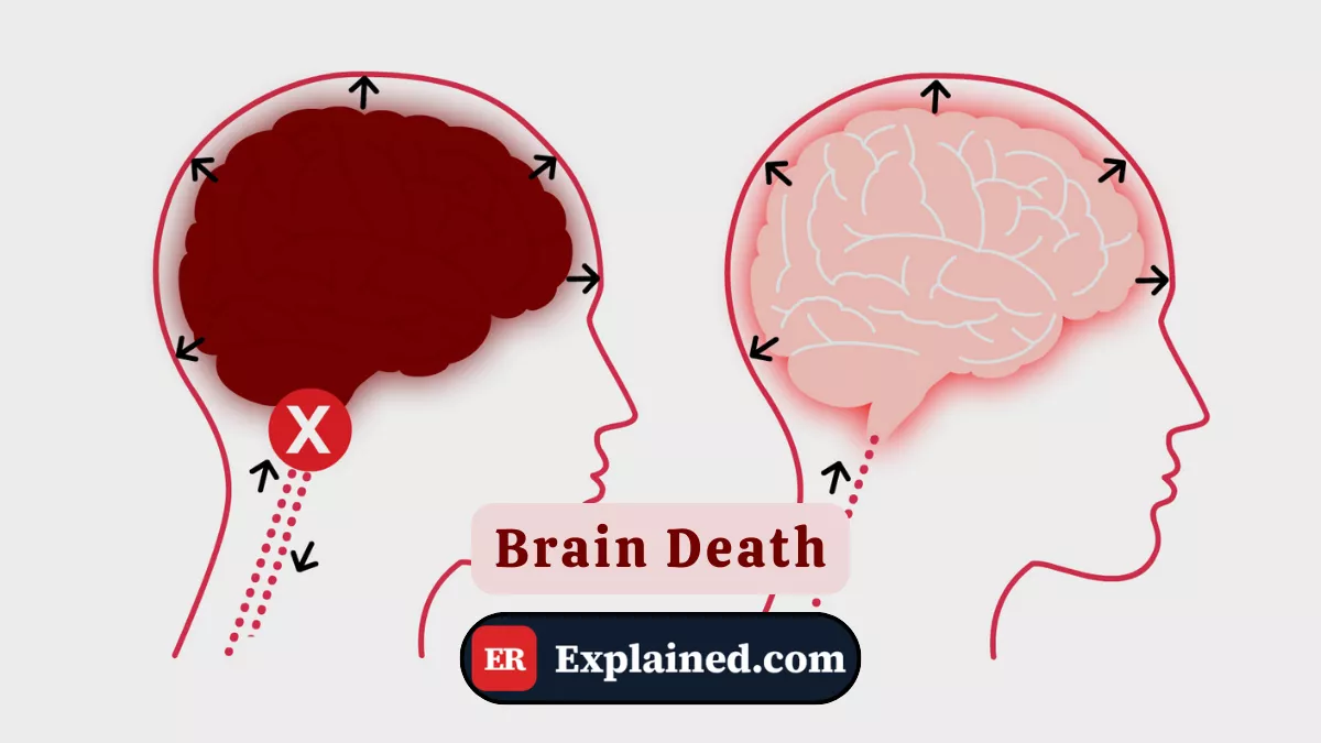 Morte Encefálica: Definição e Contexto Clínico