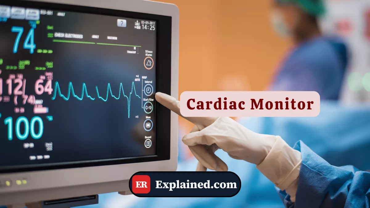 Cardiac Monitor in the ER: What It Is and Why It Saves Lives