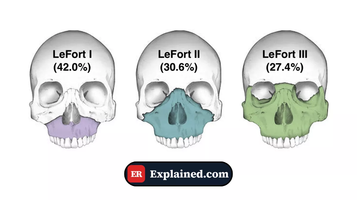Hematocolpo por Hímen Imperfurado: Amenorreia Primária e Dor Pélvica Crescente na Adolescente