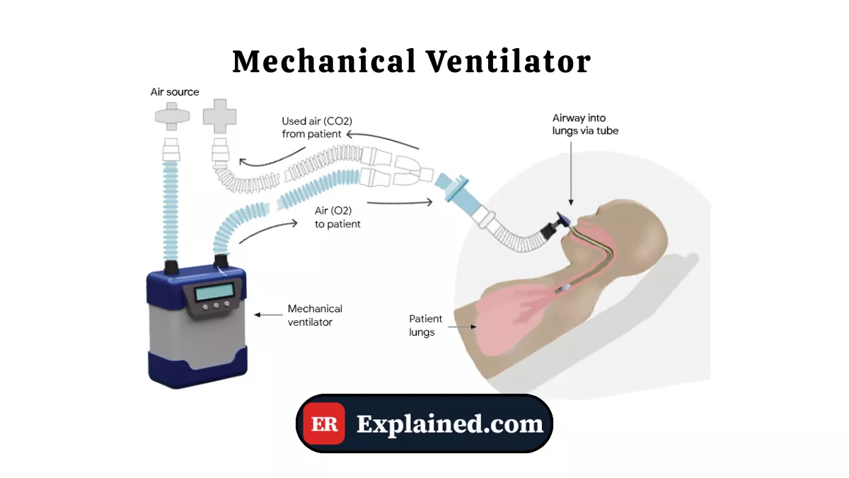 Mechanical Ventilator in the ER: What It Is and How It Works