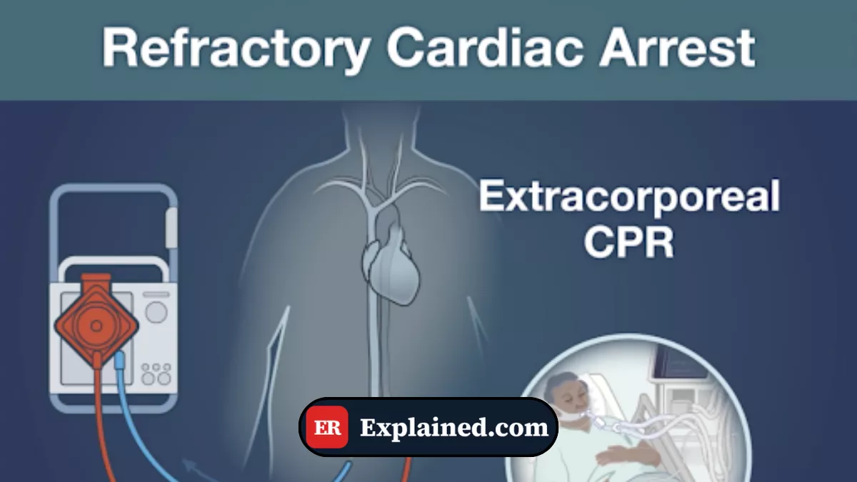 Parada Cardíaca Refratária: Quando o Coração se Recusa a Bater