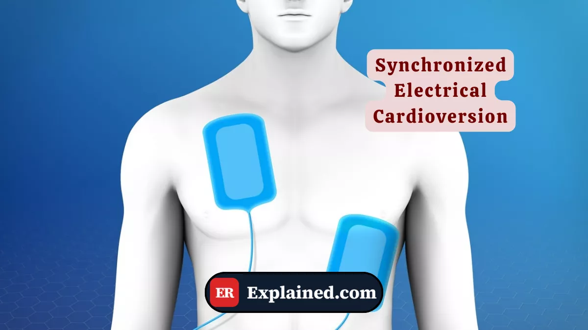 Cardioversão Elétrica Sincronizada: Como o Choque Reverte Arritmias na Emergência