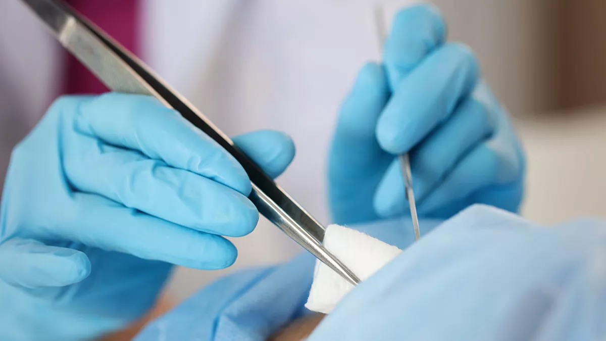 Nair in the ER: The Hair Removal Cream That Resolves Hair Tourniquet in Infants